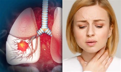 Lung Cancer Symptoms Signs Of A Tumour In Your Voice Include Having A Hoarse Throat Express Co Uk