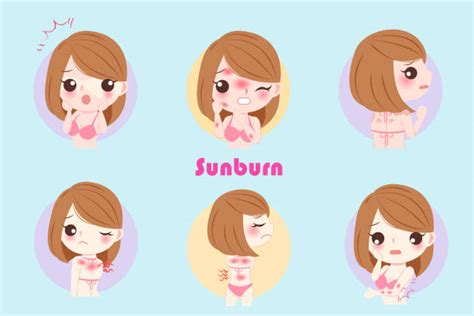 Sunburnt Back Illustrations Royalty Free Vector Graphics And Clip Art