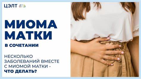 Миома матки в сочетании.  Картинка - Миома матки в сочетании.