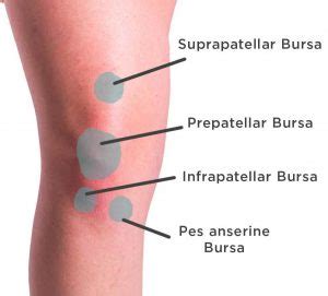 Knee Bursitis Bakers Cyst And Housemaids Knee Back In Action Physio