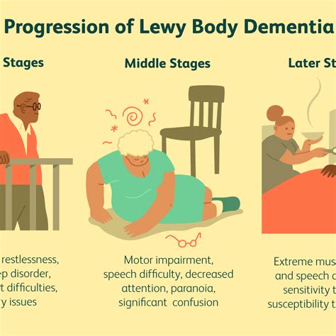 Vascular Dementia Stages Alzheimers Dementia