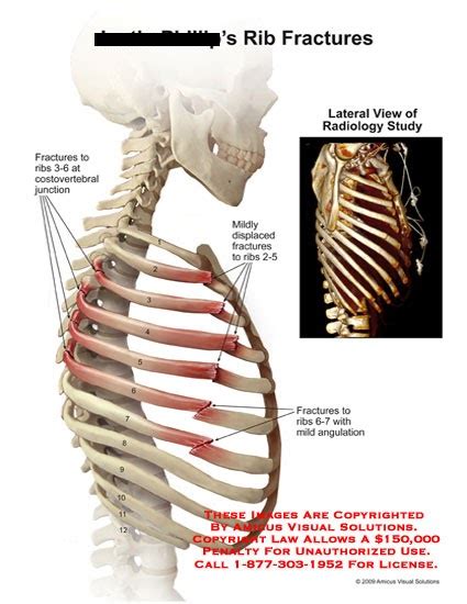 Anatomy Under The Right Rib Causes Of Pain Under Right Rib Cage