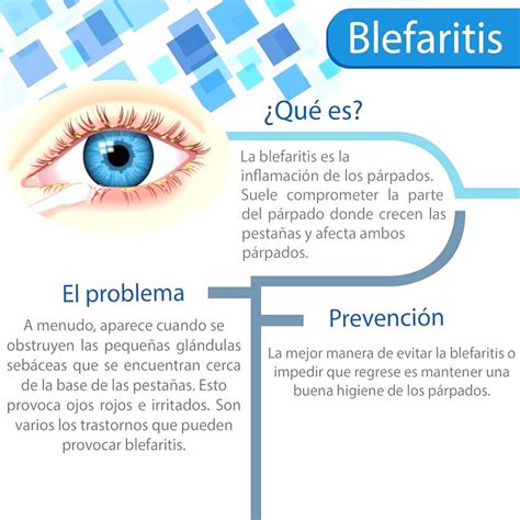 Conoce Qué Es La Blefaritis Qué Hacer Si Padeces Blefaritis Y Cómo