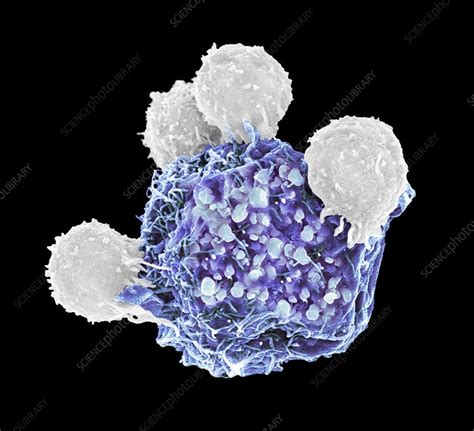 T Lymphocytes And Cancer Cell Sem Stock Image C0500609 Science