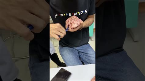 Neuroanatomy lab part 4 معيد د محمد YouTube