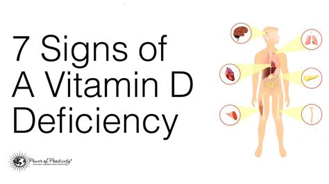 Vitamin D Deficiency Symptoms In Women The Most Common Symptoms Of Vitamin D Deficiency