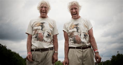 Sesampainya di rumah, undangan itu aku sampaikan ke filia. Kisah "Kembar Jim" Yang Terpisah Sejak Kecil Memiliki ...