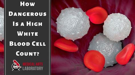 How Dangerous Is A High White Blood Cell Count