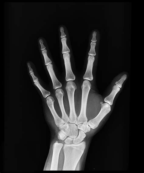 Hd Wallpaper Hand Middle Finger X Ray Radiation Finger