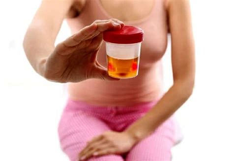Muco Na Urina Principais Causas E O Que Fazer Mundoboaforma Hot Sex