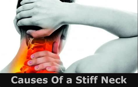 Causes Of A Stiff Neck