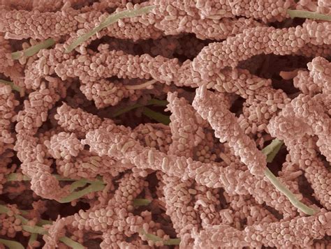 Plaque Forming Bacteria Sem Photograph By Steve Gschmeissner Pixels