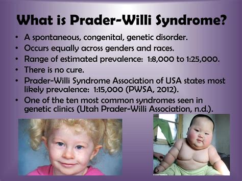 Prader Willi Syndrome