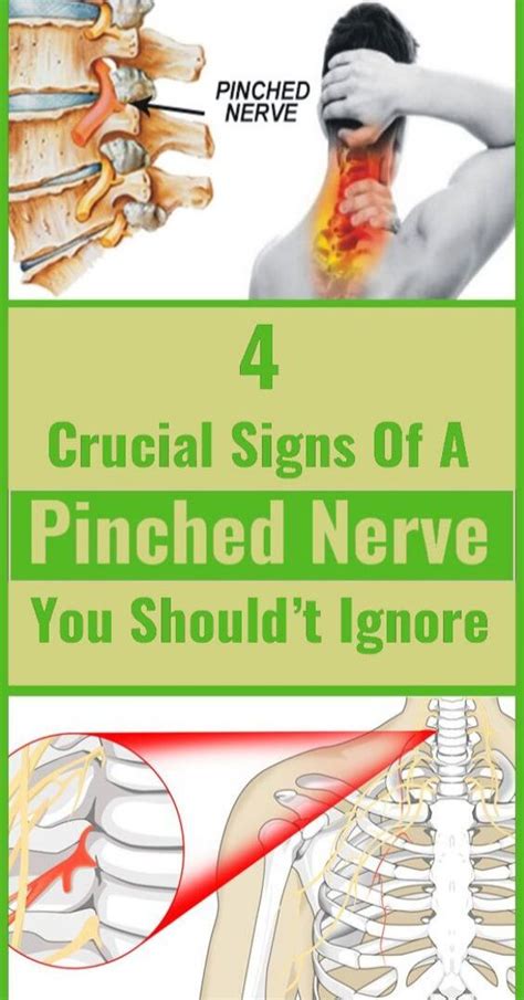 4 Crucial Signs Of A Pinched Nerve You Really Should’t Ignore Pinchednerve Lowerback