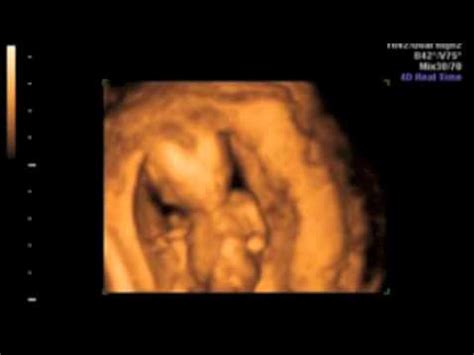 The due date likely won't be changed if mom is sure about her la. 3D 4D Ultrasound at 14 weeks 0 days (ITS A GIRL!!) - YouTube