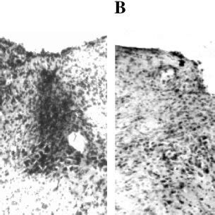 Photomicrograph Of The Dorsal Medulla At The Level Of The Obex In A Download Scientific Diagram