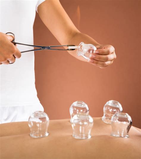 Cupping Therapy The Complete Guide