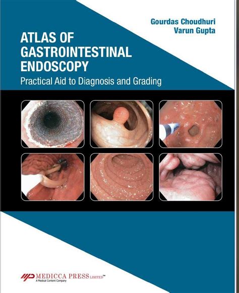 Buy Atlas Of Gastrointestinal Endoscopy Practical Aid To Diagnosis And