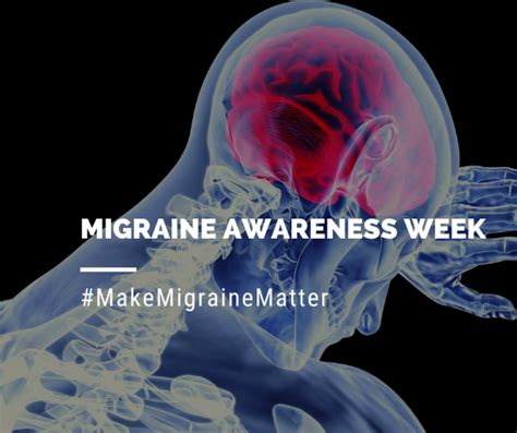 New Survey Finds Majority Of Migraine Sufferers Report More Frequent