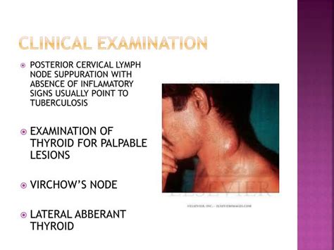 Ppt Cervical Lymphadenopathy Powerpoint Presentation Id4847833