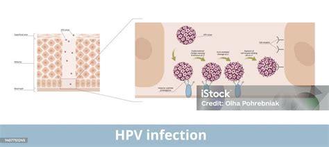 Hpv Infection Stock Illustration Download Image Now Biological Cell