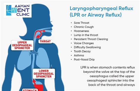 Silent Reflux Throat Acidity Aahan Ent Clinic Drajay Doiphode