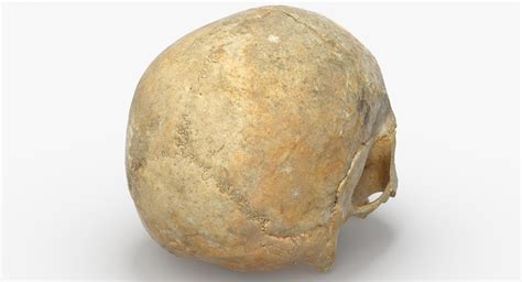 Human Skull Cranium Leprosy 3d Model Turbosquid 1537597