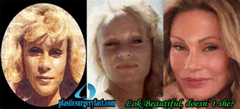Cat Lady Plastic Surgery Jocelyn Wildenstein Gone Wrong