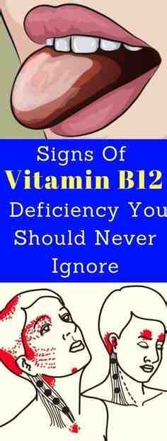The recommended vitamin b12 dosage for breastfeeding women is 2.8 micrograms daily. Lack Of Vitamin Dizziness Earwigs Is Purpose What ...