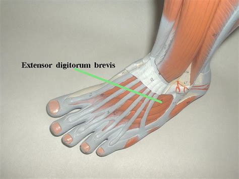 Flexor Digitorum Brevis Muscle Pain