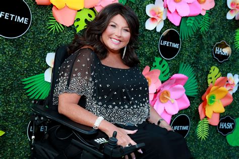 Descubrir 101 Imagen Why Is Abby Lee In A Wheelchair Abzlocalmx