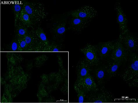 Integrin Alpha 2 Recombinant Rabbit Monoclonal Antibody长沙艾碧维生物科技有限公司