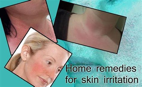 Effective Home Remedies For Skin Irritation