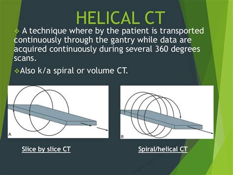 Helical And Multislice Ct