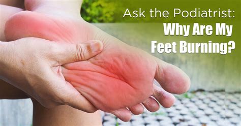 Ask The Podiatrist Why Are My Feet Burning Curafoot