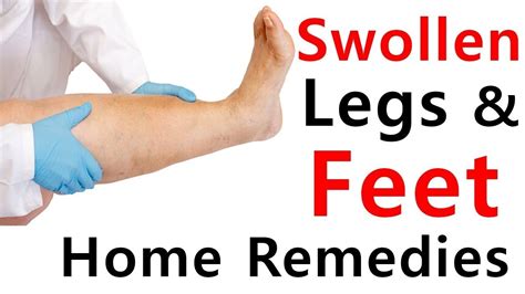 How To Get Rid Of Swollen Feet Fast Natural Home Remedies Youtube