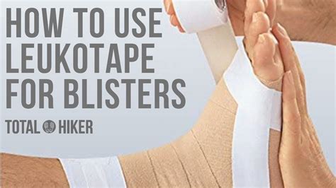 How To Use Leukotape For Blisters Treatment And Prevention