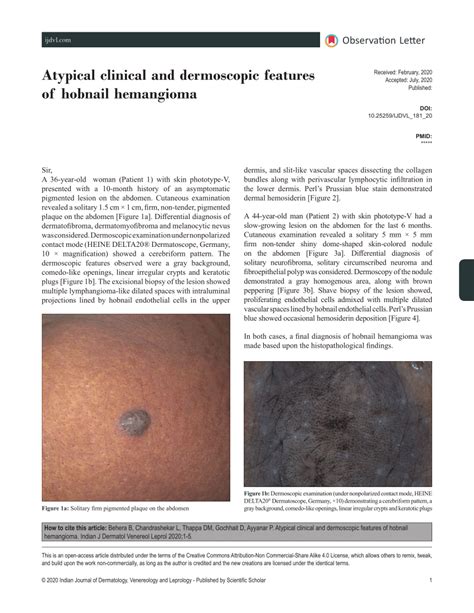 Pdf Atypical Clinical And Dermoscopic Features Of Hobnail Hemangioma