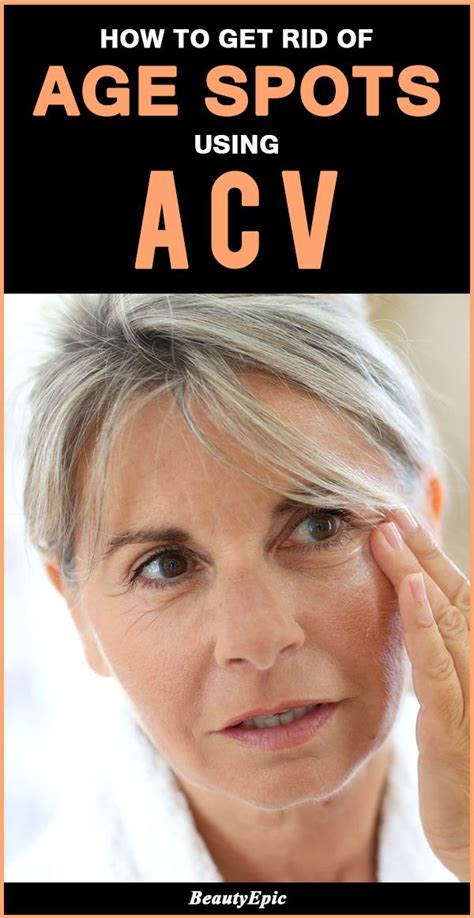 How To Treat Age Spots With Apple Cider Vinegar Age Spots On Face Brown Age Spots Skin