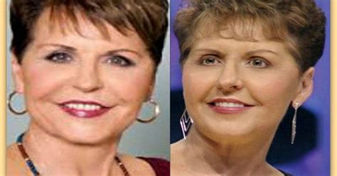 Joyce Meyer Plastic Surgery Before And After Joycemeyerplasticsurgery Joycemeyer