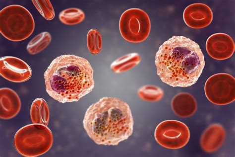 13 Signs Of Blood Cell Disorders And 25 Natural Remedies Daily Health