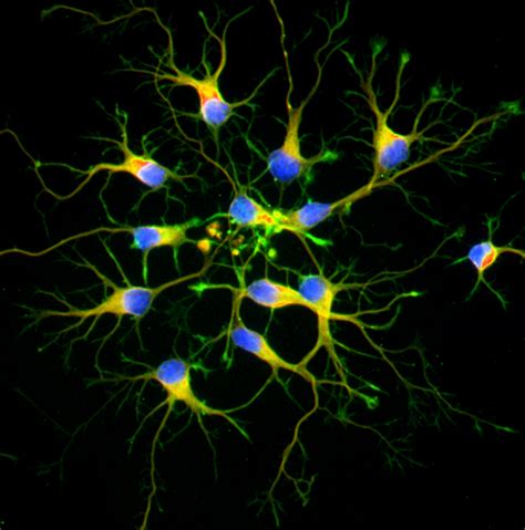Primary Neurons Vs Neuronal Cell Lines Sciencell Research Laboratories