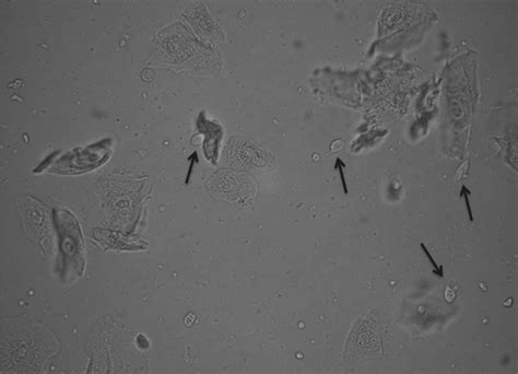 Trichomonas Vaginalis Under Microscope