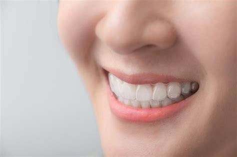 What Is The Best Age For Clear Aligners Walied Touni Dds Msd Orthodontist