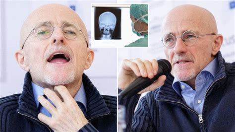 Surgeon Claims Hes Performed Worlds First Human Head Transplant On A Corpse