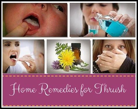 Home Remedies For Thrush Medi Tricks Home Remedies For Thrush Home