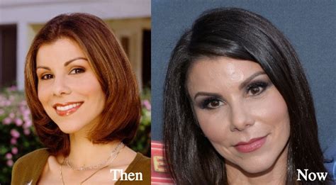 Heather Dubrow Plastic Surgery Before And After Pictures