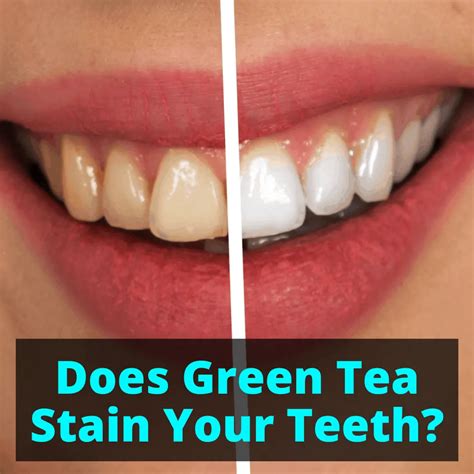 Does Green Tea Stain Your Teeth 2023