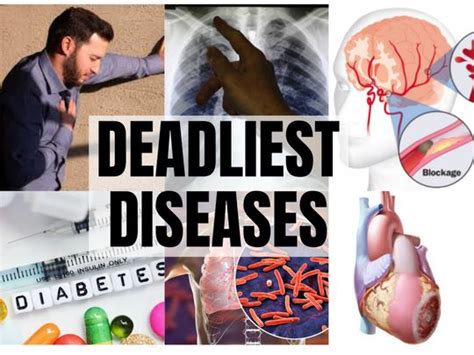 Worlds Top 10 Deadliest Diseases World Gulf News