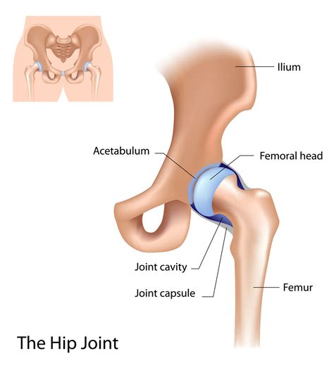 Labral Tear In The Hip